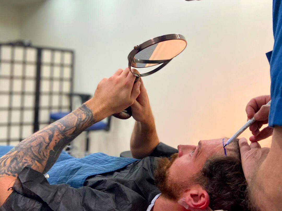 Er hárígræðsla rétt fyrir mig?